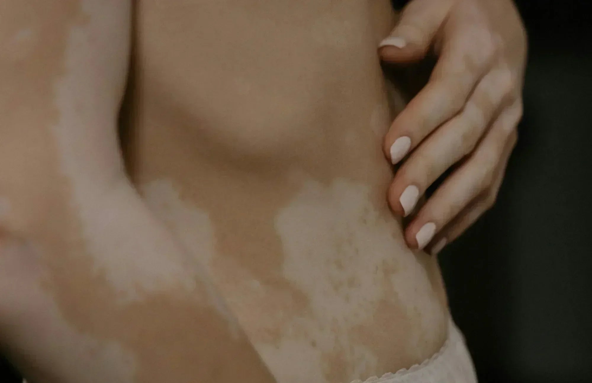 close-up of a person’s hand on their torso with skin discoloration and blog title overlay about probiotics for diarrhea